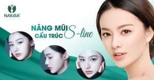 Nâng mũi S Line cấu trúc