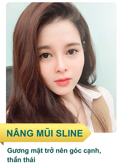 nang mui sline dep chuan