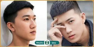 nang mui tai tham my nakisa