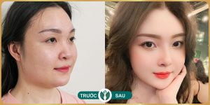 nang mui tai tham my nakisa