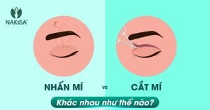 Nhấn mí và cắt mí khác nhau như thế nào