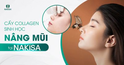 Cấy collagen sinh học nâng mũi