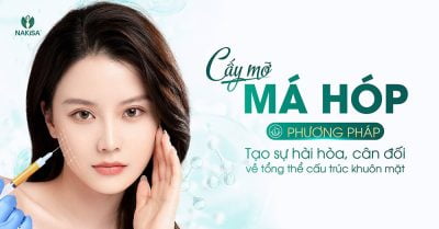 Cấy mỡ má - Thẩm mỹ NAKISA