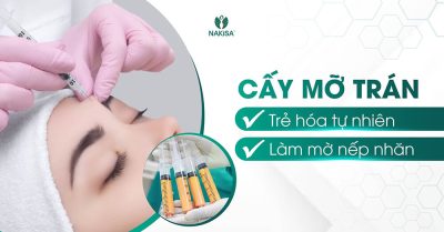 Cấy mỡ trán: Trẻ hóa tự nhiên - làm mờ nếp nhăn
