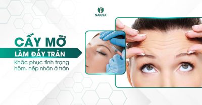 Quy trình cấy mỡ trán
