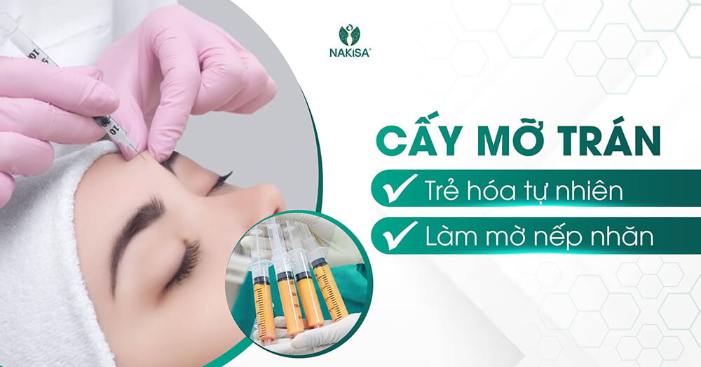 Cấy mỡ trán: Trẻ hóa tự nhiên - làm mờ nếp nhăn