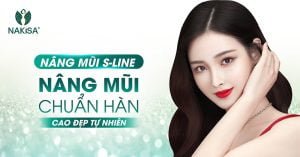Nâng mũi S Line dáng mũi tự nhiên, thần thái ngời ngời