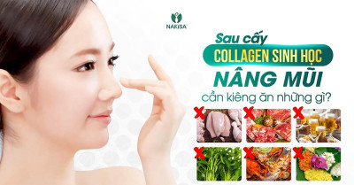 Sau cấy collagen sinh học nâng mũi, cần kiêng ăn những gì