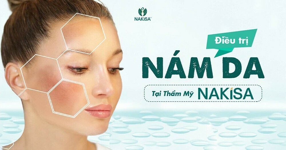 Điều trị nám da hiệu quả