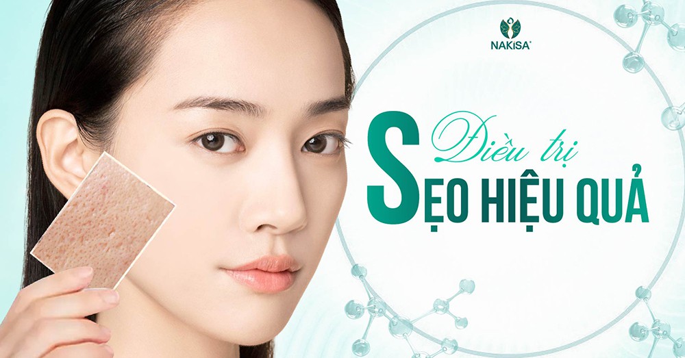 Điều trị sẹo hiệu quả an toàn