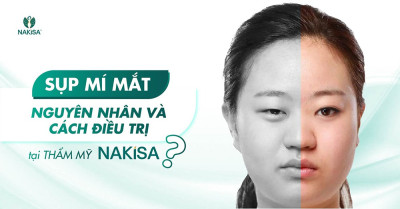 Điều trị sụp mí mắt