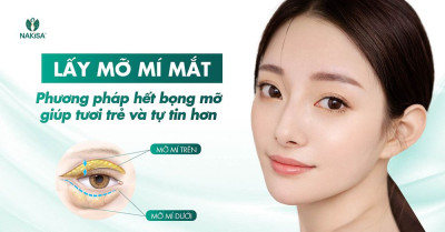 Lấy mỡ mí mắt
