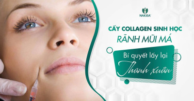 Cấy collagen sinh học rãnh mũi má