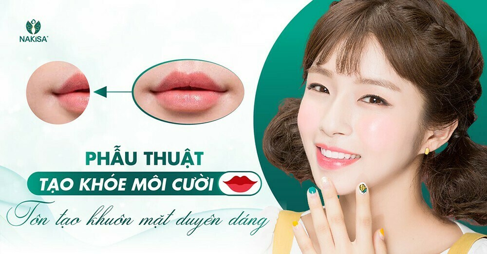Phẫu thuật tạo khóe môi cười