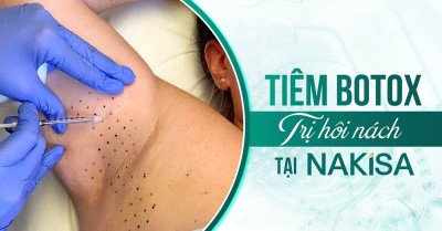 Tiêm Botox điều trị hôi nách