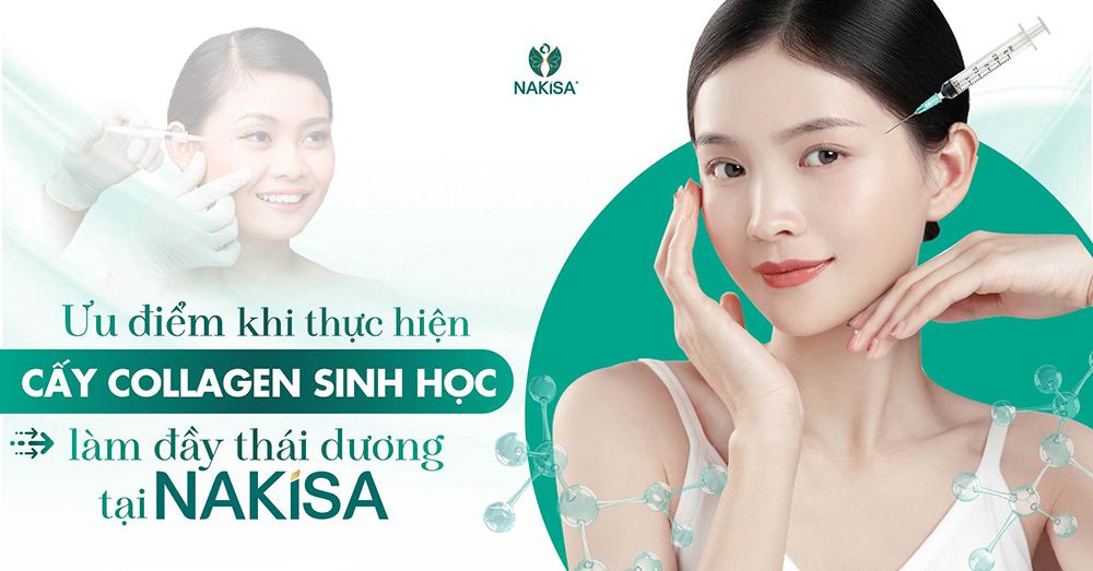 Ưu điểm làm đầy thái dương