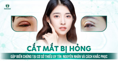 Cắt mắt bị hỏng gặp biến chứng tại cơ sở thiếu uy tín
