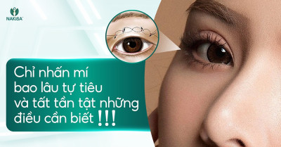 Chỉ nhấn mí bao lâu tự tiêu và tất tần tật những điều cần biết
