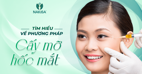 Cấy mỡ hốc mắt bao lâu thì hết sưng