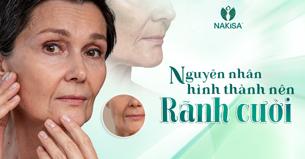 Cấy mỡ rãnh cười 